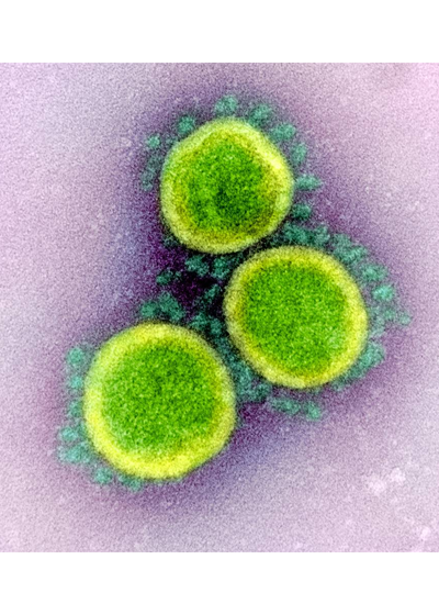 How Long Can The Virus That Causes Covid-19 Live On Surfaces?